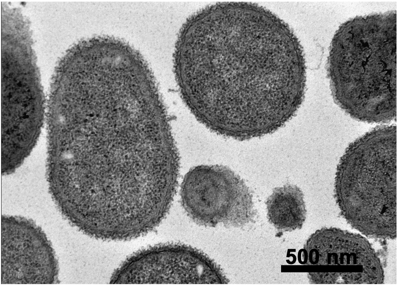 Transmission Electron Microscopy